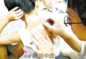 灸法的種類  你知道多少？