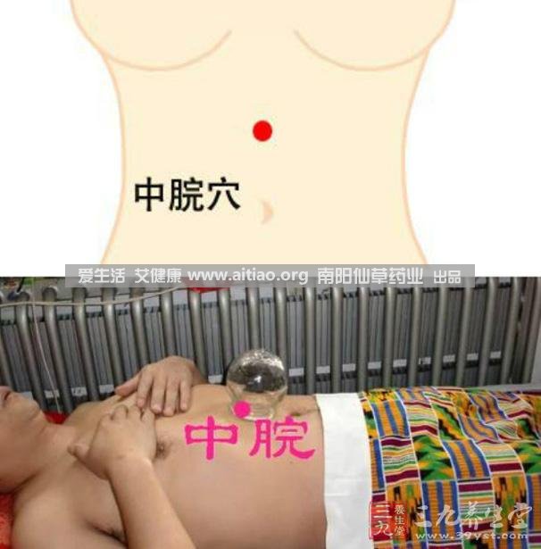 中脘穴位于腹部正中線，臍上4寸的位置上。每天艾灸10-15分鐘，能有效緩解胃部不適的癥狀，同時有助于祛濕。